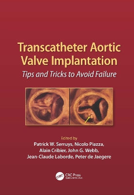Transcatheter Aortic Valve Implantation book