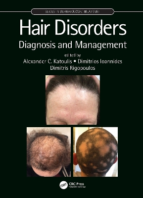 Hair Disorders: Diagnosis and Management book