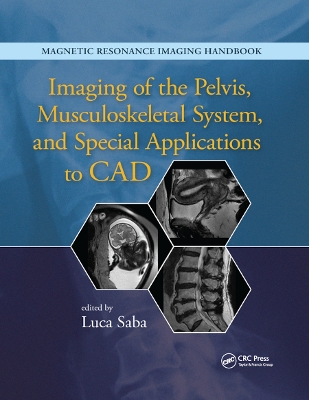 Imaging of the Pelvis, Musculoskeletal System, and Special Applications to CAD book