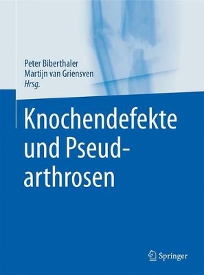 Knochendefekte und Pseudarthrosen book