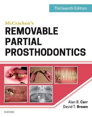 McCracken's Removable Partial Prosthodontics book