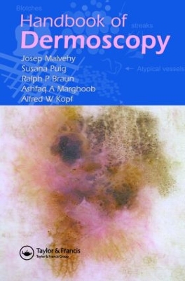 Handbook of Dermoscopy book