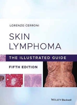 Skin Lymphoma: The Illustrated Guide book