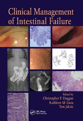 Clinical Management of Intestinal Failure book