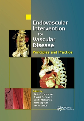 Endovascular Intervention for Vascular Disease: Principles and Practice by Matt M. Thompson