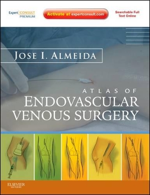 Atlas of Endovascular Venous Surgery book