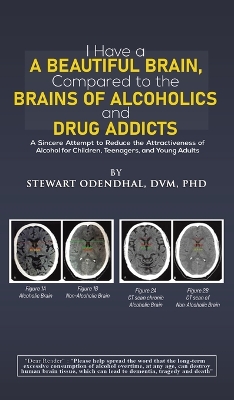 I Have a Beautiful Brain, Compared to the Brains of Alcoholics and Drug Addicts: A Sincere Attempt to Reduce the Attractiveness of Alcohol for Children, Teenagers, and Young Adults by Stewart Odendhal, DVM, PhD