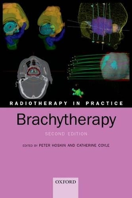 Radiotherapy in Practice - Brachytherapy book
