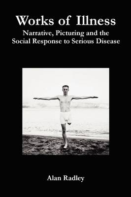 Works of Illness: Narrative, Picturing and the Social Response to Serious Disease book