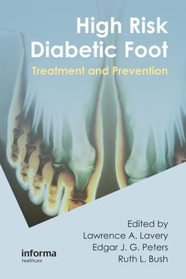 High Risk Diabetic Foot: Treatment and Prevention by Lawrence A. Lavery