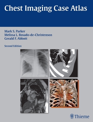 Chest Imaging Case Atlas book