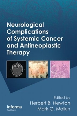 Neurological Complications of Systemic Cancer and Antineoplastic Therapy book