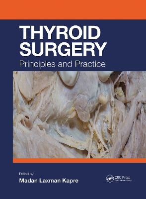 Thyroid Surgery: Principles and Practice book
