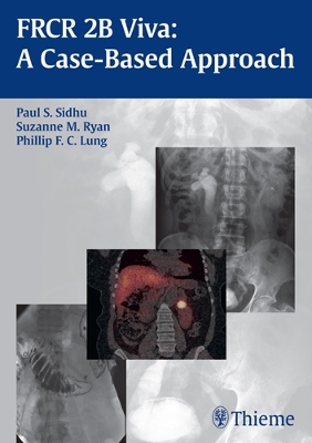 FRCR 2B Viva: a Case-based Approach book