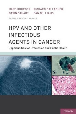 HPV and Other Infectious Agents in Cancer book