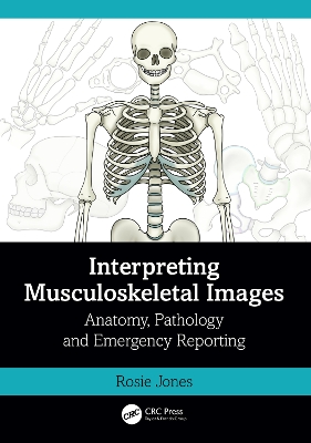 Interpreting Musculoskeletal Images: Anatomy, Pathology and Emergency Reporting by Rosie Jones