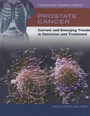 Prostate Cancer book