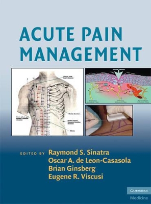 Acute Pain Management book