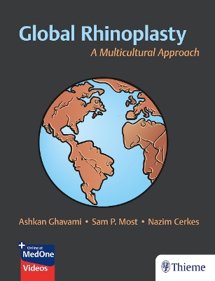 Global Rhinoplasty: A Multicultural Approach book