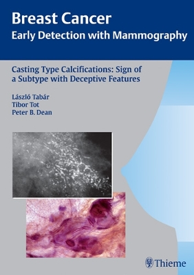 Casting-Type Calcifications: Sign of a Subtype with Deceptive Features book