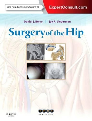 Surgery of the Hip book