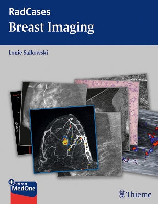 Radcases Breast Imaging book