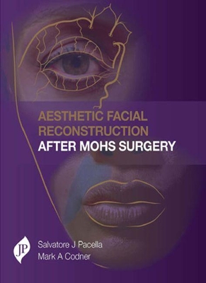 Aesthetic Facial Reconstruction After Mohs Surgery book