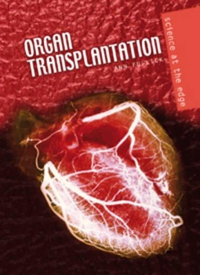 Organ Transplantation book