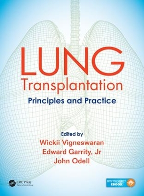 Lung Transplantation: Principles and Practice by Wickii Vigneswaran