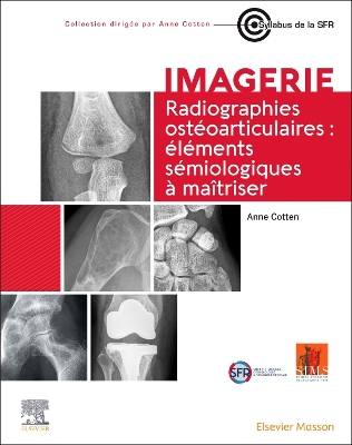 Radiographies ostéoarticulaires : éléments sémiologiques à maitriser by Anne Cotten