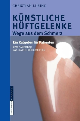 Künstliche Hüftgelenke: Wege aus dem Schmerz book