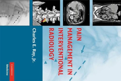 Pain Management in Interventional Radiology book