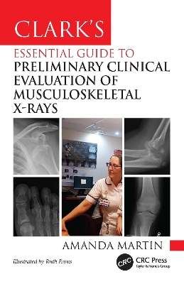 Clark’s Essential Guide to Preliminary Clinical Evaluation of Musculoskeletal X-rays book