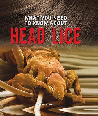 What You Need to Know about Head Lice by Nancy Dickmann
