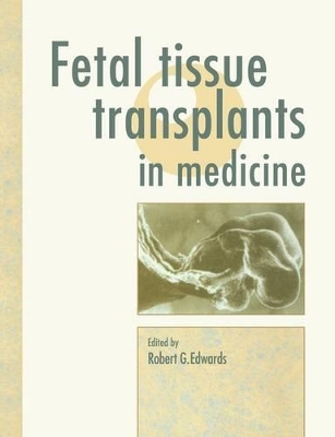 Fetal Tissue Transplants in Medicine book