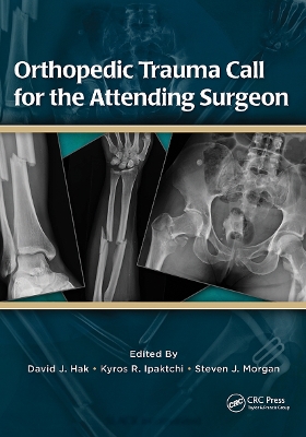 Orthopedic Trauma Call for the Attending Surgeon book