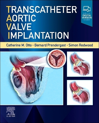 Transcatheter Aortic Valve Implantation book