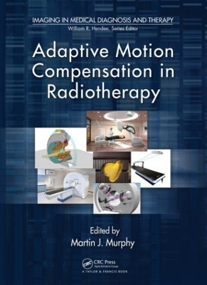 Adaptive Motion Compensation in Radiotherapy book