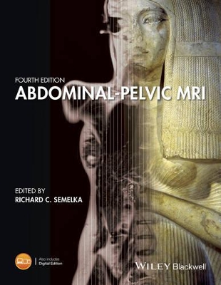 Abdominal-Pelvic MRI book