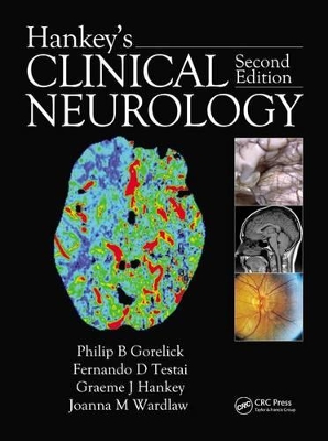 Hankey's Clinical Neurology book