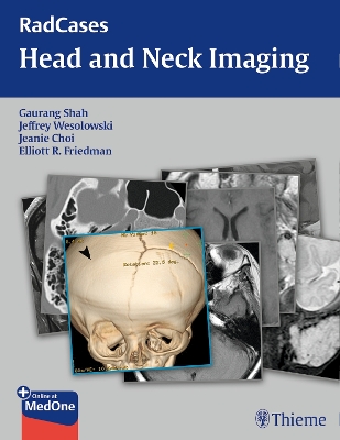 RadCases Head and Neck Imaging book