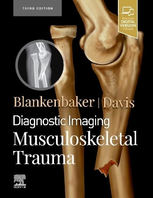 Diagnostic Imaging: Musculoskeletal Trauma by Donna G Blankenbaker