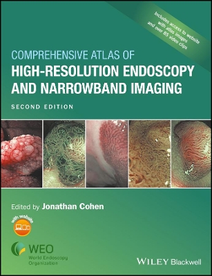 Comprehensive Atlas of High-Resolution Endoscopy and Narrowband Imaging book