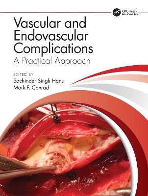 Vascular and Endovascular Complications: A Practical Approach book