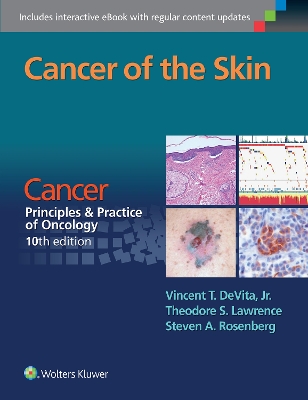 Cancer of the Skin by Vincent T DeVita