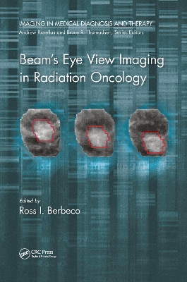 Beam's Eye View Imaging in Radiation Oncology by Ross I. Berbeco, Ph.D.