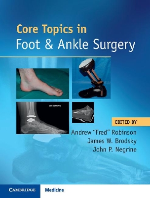 Core Topics in Foot and Ankle Surgery book