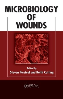 Microbiology of Wounds by Steven Percival