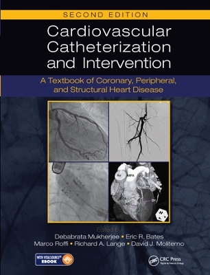 Cardiovascular Catheterization and Intervention: A Textbook of Coronary, Peripheral, and Structural Heart Disease, Second Edition book