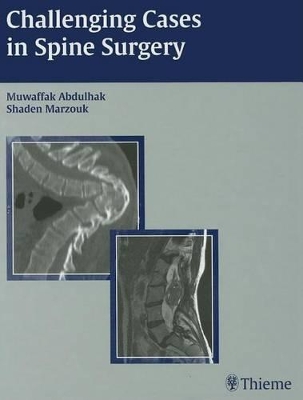 Challenging Cases in Spine Surgery book